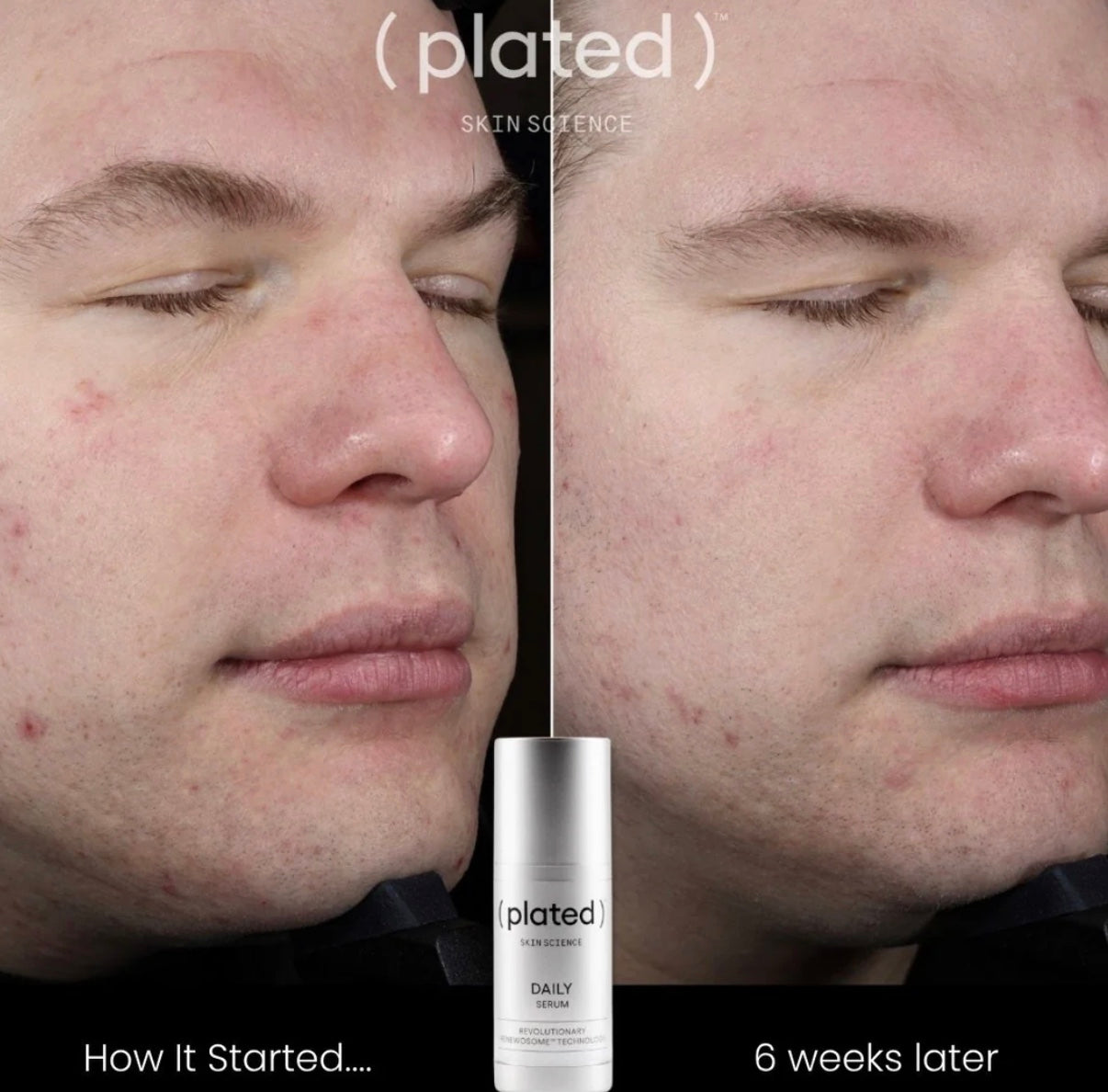PLATED™ DAILY Serum